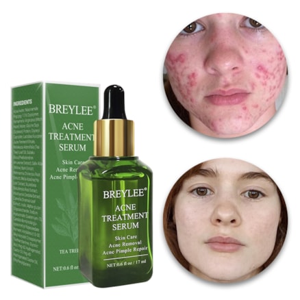 Acne Treatment Serum Breylee 17ml