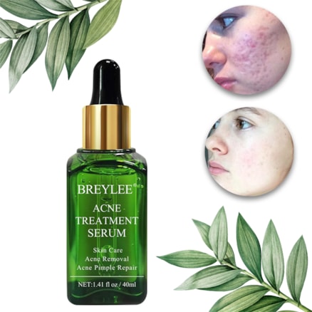 Acne Treatment Serum Breylee 17ml