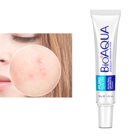 Pure Skin Anti Acne Bioaqua 30g