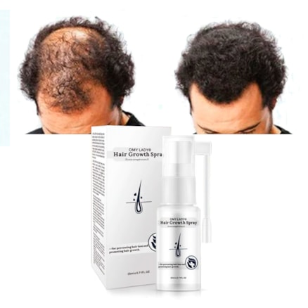 Spray Anti Queda Capilar Para Homens Crescimento De Cabelos