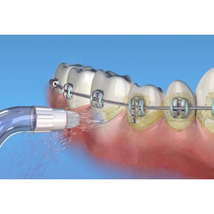 Vaclav Irrigador Oral Portátil Sem Fio 1501 Bivolt Sem Fio